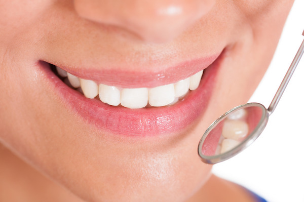 Teeth Whitening Lanta Dente